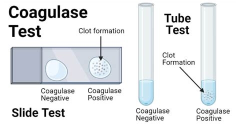 coagulase test results